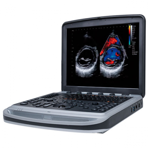 Chison SonoBook 9